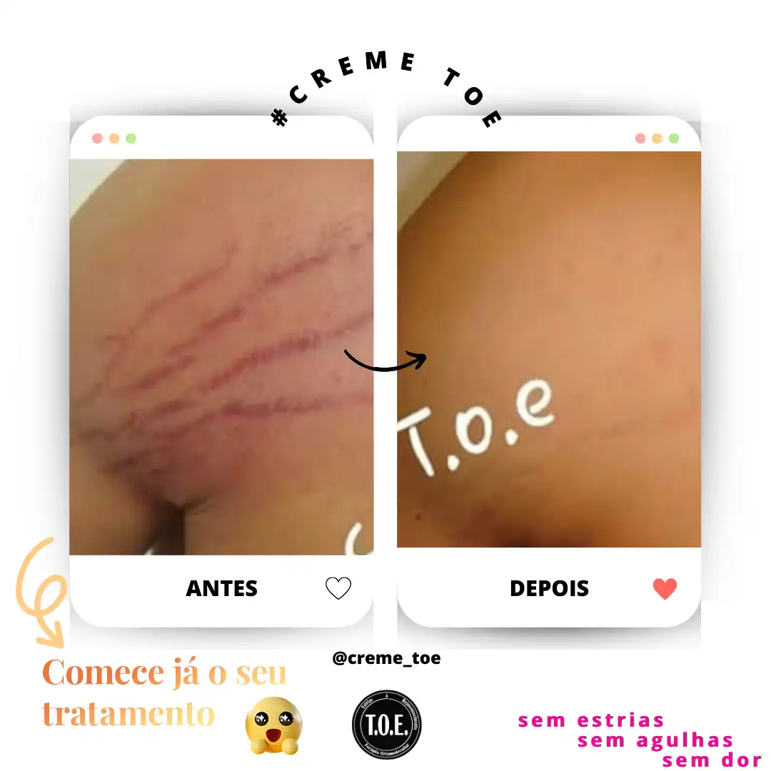 Resultado em 30 dias