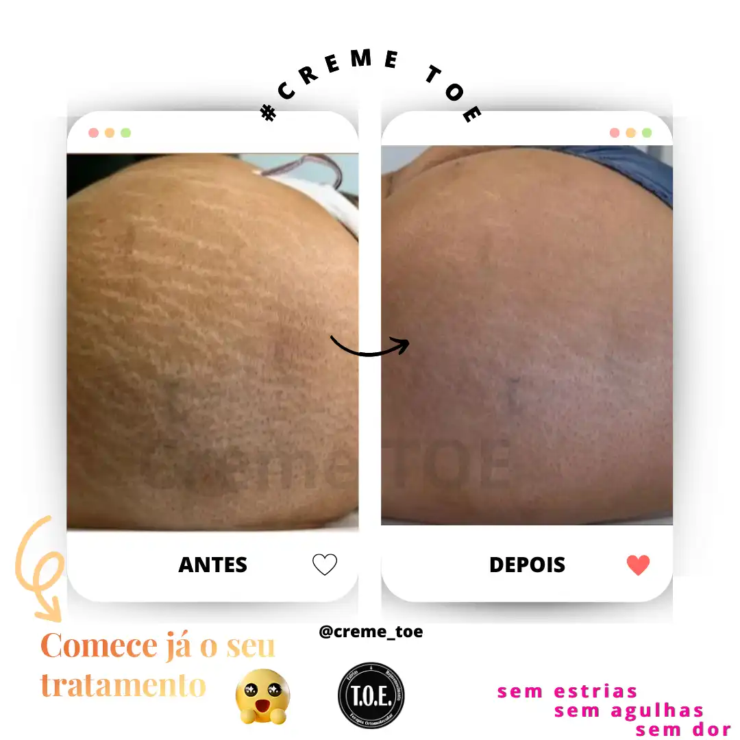 Resultado em 60 dias